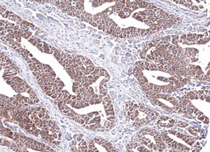 Immunohistochemistry (Formalin/PFA-fixed paraffin-embedded sections) - Anti-PCCB antibody (AB96729)
