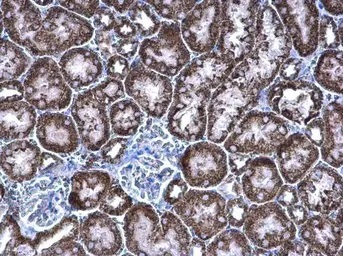 Immunohistochemistry (Formalin/PFA-fixed paraffin-embedded sections) - Anti-PCCB antibody (AB96729)