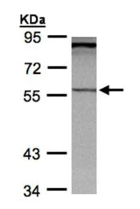 Western blot - Anti-PCCB antibody (AB96729)