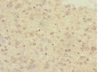 Immunohistochemistry (Formalin/PFA-fixed paraffin-embedded sections) - Anti-PCDH10 antibody (AB230408)