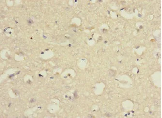 Immunohistochemistry (Formalin/PFA-fixed paraffin-embedded sections) - Anti-PCDH10 antibody (AB230408)