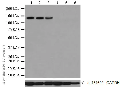 Western blot - Anti-PCDH11X antibody [EPR16916] (AB203520)