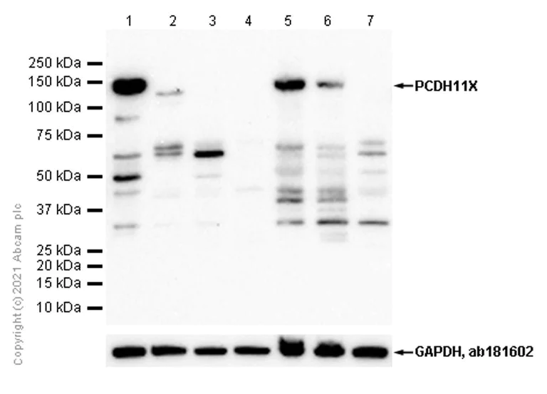 Western blot - Anti-PCDH11X antibody [EPR16916] (AB203520)