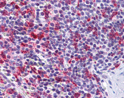 Immunohistochemistry (Formalin/PFA-fixed paraffin-embedded sections) - Anti-PCDH12 antibody (AB113720)