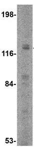 Western blot - Anti-PCDH12 antibody (AB113720)
