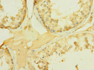 Immunohistochemistry (Formalin/PFA-fixed paraffin-embedded sections) - Anti-PCDH15 antibody (AB230346)