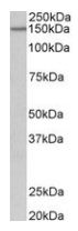 Western blot - Anti-PCDH17 antibody (AB128815)