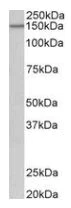 Western blot - Anti-PCDH17 antibody (AB128815)