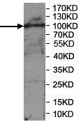 Western blot - Anti-PCDH20 antibody (AB197196), expandable thumbnail
