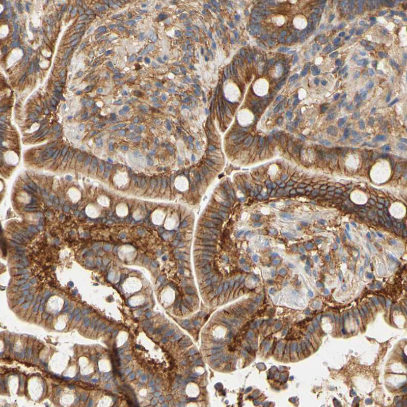 Immunohistochemistry (Formalin/PFA-fixed paraffin-embedded sections) - Anti-PCDH7 antibody (AB224084), expandable thumbnail