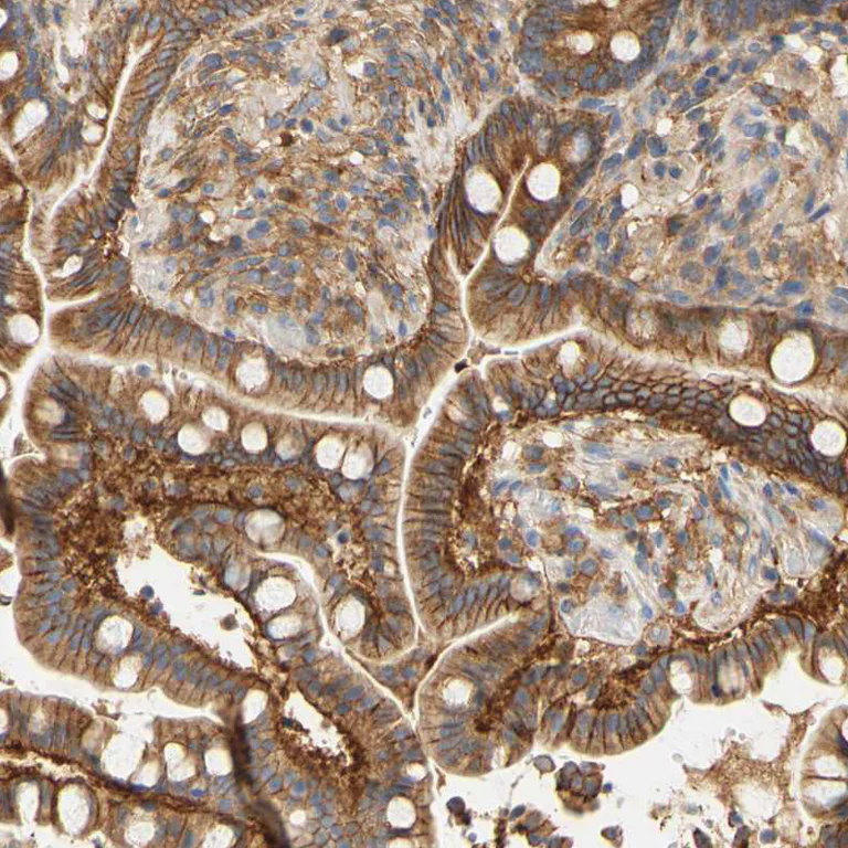 Immunohistochemistry (Formalin/PFA-fixed paraffin-embedded sections) - Anti-PCDH7 antibody (AB224084)