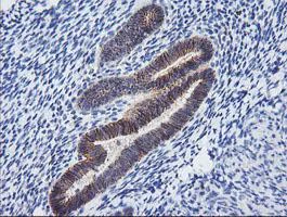 Immunohistochemistry (Formalin/PFA-fixed paraffin-embedded sections) - Anti-PCDH7 antibody [OTI2G6] (AB139274)