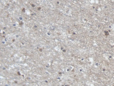 Immunohistochemistry (Formalin/PFA-fixed paraffin-embedded sections) - Anti-PCDHA1 antibody (AB231152), expandable thumbnail