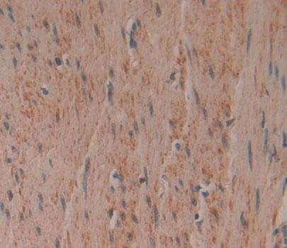 Immunohistochemistry (Formalin/PFA-fixed paraffin-embedded sections) - Anti-PCDHB15 antibody (AB233195)