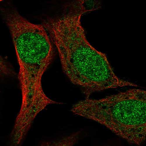 Immunocytochemistry/ Immunofluorescence - Anti-PCF11 antibody (AB220278), expandable thumbnail