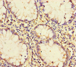 Immunohistochemistry (Formalin/PFA-fixed paraffin-embedded sections) - Anti-PCF11 antibody (AB222819), expandable thumbnail