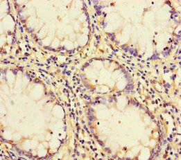 Immunohistochemistry (Formalin/PFA-fixed paraffin-embedded sections) - Anti-PCF11 antibody (AB222819)