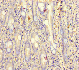 Immunohistochemistry (Formalin/PFA-fixed paraffin-embedded sections) - Anti-PCF11 antibody (AB222819), expandable thumbnail