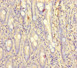 Immunohistochemistry (Formalin/PFA-fixed paraffin-embedded sections) - Anti-PCF11 antibody (AB222819)