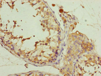 Immunohistochemistry (Formalin/PFA-fixed paraffin-embedded sections) - Anti-PCID1 antibody (AB230105), expandable thumbnail