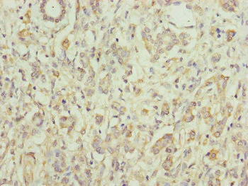 Immunohistochemistry (Formalin/PFA-fixed paraffin-embedded sections) - Anti-PCID1 antibody (AB230105)