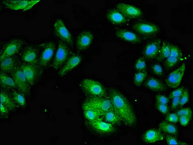 Immunocytochemistry/ Immunofluorescence - Anti-PCID1 antibody (AB237504)