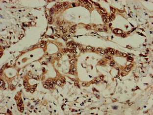 Immunohistochemistry (Formalin/PFA-fixed paraffin-embedded sections) - Anti-PCID1 antibody (AB237504)