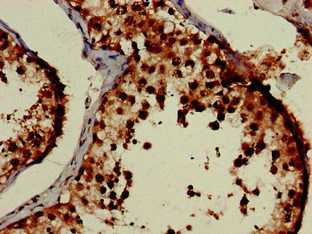 Immunohistochemistry (Formalin/PFA-fixed paraffin-embedded sections) - Anti-PCID1 antibody (AB237504)