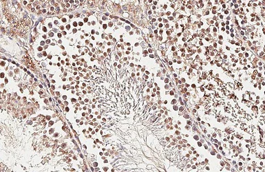 Immunohistochemistry (Formalin/PFA-fixed paraffin-embedded sections) - Anti-PCID2 antibody (AB227559)
