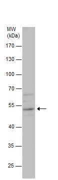 Western blot - Anti-PCID2 antibody (AB227559)