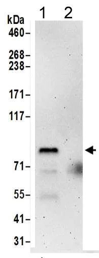 Immunoprecipitation - Anti-PCIF1 antibody (AB205016)