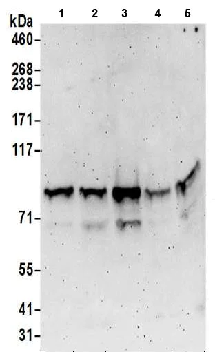 Western blot - Anti-PCIF1 antibody (AB205016)