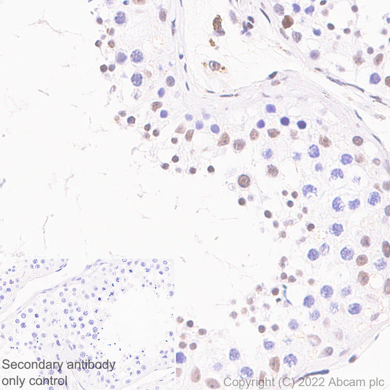 Immunohistochemistry (Formalin/PFA-fixed paraffin-embedded sections) - Anti-PCIF1 antibody [EPR24319-207] (AB300487)