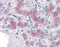 Immunohistochemistry (Formalin/PFA-fixed paraffin-embedded sections) - Anti-PCK1/PEPC antibody (AB115693)