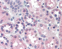 Immunohistochemistry (Formalin/PFA-fixed paraffin-embedded sections) - Anti-PCK1/PEPC antibody (AB115693)