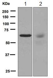Western blot - Anti-PCK1/PEPC antibody [EPR6939] (AB125003)