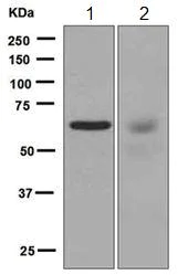 Western blot - Anti-PCK1/PEPC antibody [EPR6939] - BSA and Azide free (AB248094)