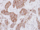 Immunohistochemistry (Formalin/PFA-fixed paraffin-embedded sections) - Anti-PCK2 antibody (AB137580)