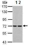 Western blot - Anti-PCK2 antibody (AB137580)