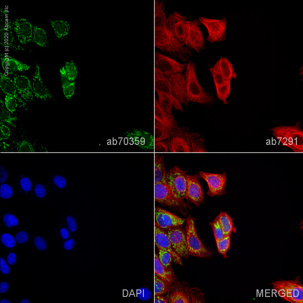 Anti-PCK2 antibody