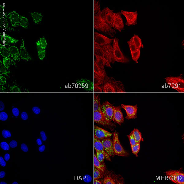Immunocytochemistry/ Immunofluorescence - Anti-PCK2 antibody (AB70359)