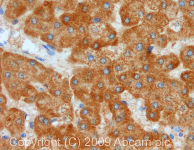 Immunohistochemistry (Formalin/PFA-fixed paraffin-embedded sections) - Anti-PCK2 antibody (AB70359)