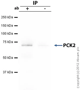 Immunoprecipitation - Anti-PCK2 antibody (AB70359)