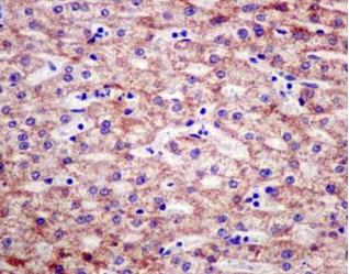Immunohistochemistry (Formalin/PFA-fixed paraffin-embedded sections) - Anti-PCK2 antibody [EPR14223(B)] (AB181170)