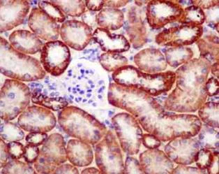 Immunohistochemistry (Formalin/PFA-fixed paraffin-embedded sections) - Anti-PCK2 antibody [EPR14223(B)] (AB181170)