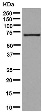 Western blot - Anti-PCK2 antibody [EPR14223(B)] (AB181170)