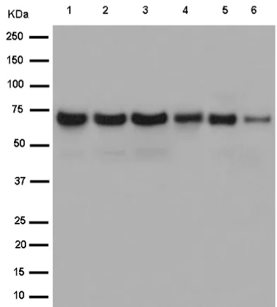 Western blot - Anti-PCK2 antibody [EPR14224] - C-terminal (AB187145)