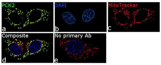 Immunocytochemistry/ Immunofluorescence - Anti-PCK2 antibody [RP23040240] (AB308126)