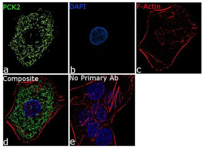 Immunocytochemistry/ Immunofluorescence - Anti-PCK2 antibody [RP23040240] (AB308126)