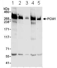 Western blot - Anti-PCM1 antibody (AB72443), expandable thumbnail
